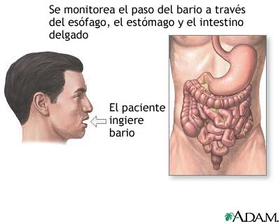 Ingesti&oacute;n de bario