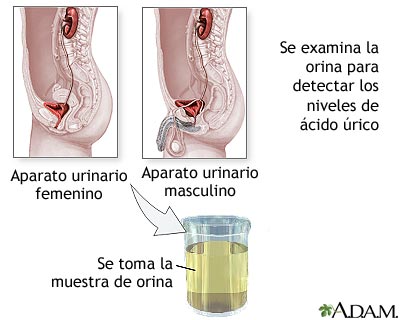 Prueba de &aacute;cido &uacute;rico