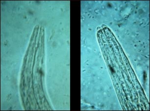 Boca de un anquilostoma