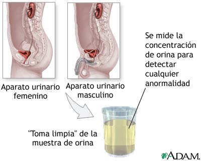 Prueba de concentraci&oacute;n de orina