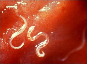 Anquilostoma, Ancyclostoma caninum