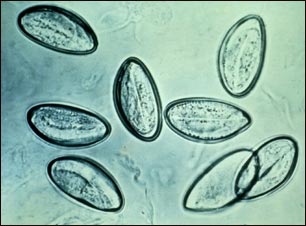 Huevos de lombrices intestinales