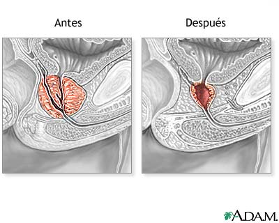 Cuidados postoperatorios