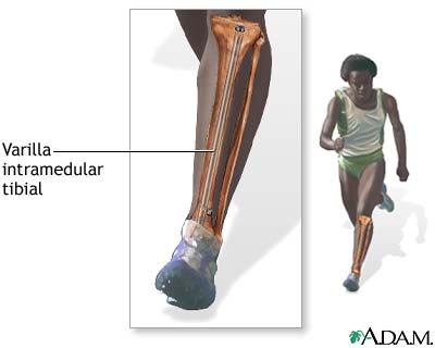 Cuidados postoperatorios