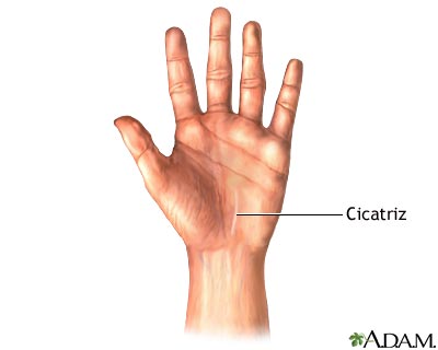 Cuidados postoperatorios