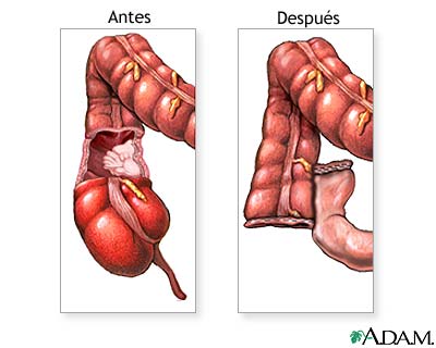 Cuidados postoperatorios
