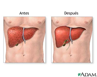 Cuidados postoperatorios