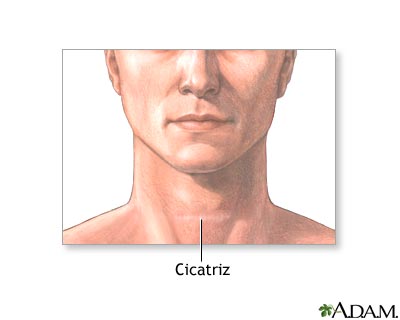 Cuidados postoperatorios