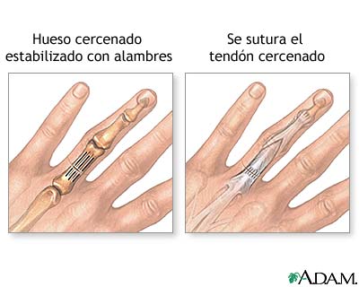 Procedimiento (primera parte)