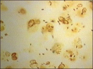 Enfermedad del legionario- organismo Legionella