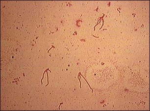 Organismo Yersinia enterocol&iacute;tica