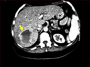 Tracto urinario masculino