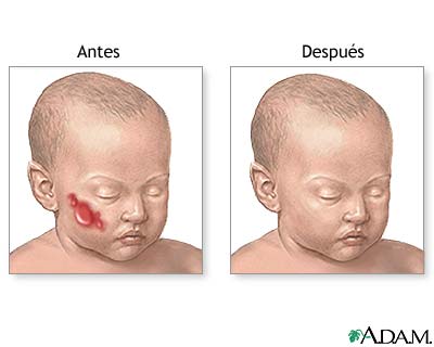 Cuidados postoperatorios