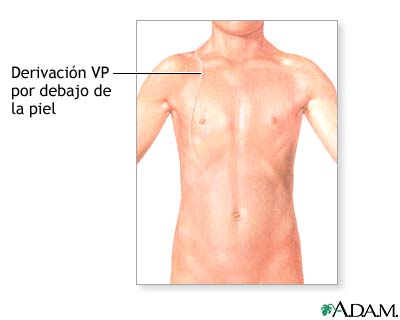 Cuidados postoperatorios
