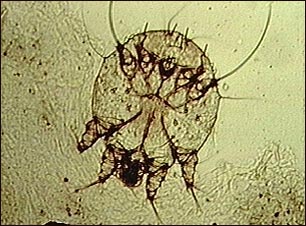Microfotograf&iacute;a del &aacute;caro de la escabiosis