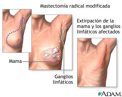 Procedimiento (segunda parte)