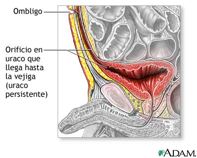 Indicaciones