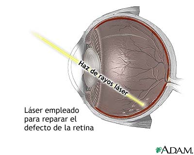 Procedimiento (segunda parte)