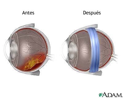 Cuidados postoperatorios