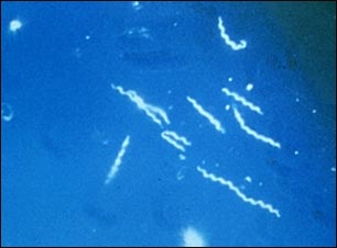 Enfermedad de Lyme, organismo Borrelia burgdorferi