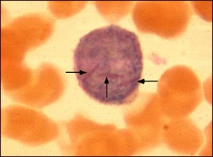 Bast&oacute;n de Auer