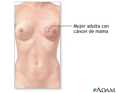 Indicaciones (primera parte)