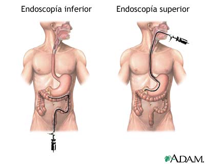 Procedimiento (primera parte)