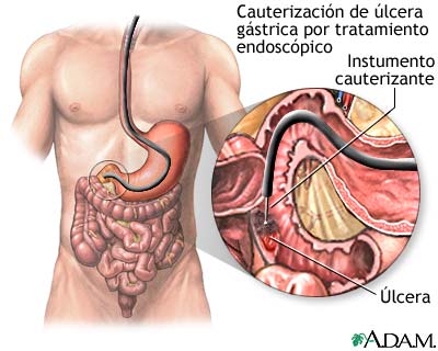 Procedimiento (segunda parte)