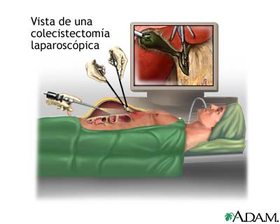 Procedimiento (segunda parte)