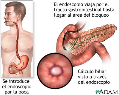 Procedimiento (primera parte)