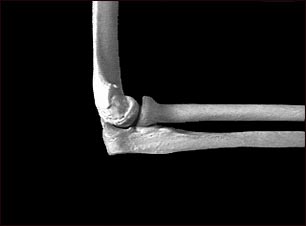 Codo - vista lateral