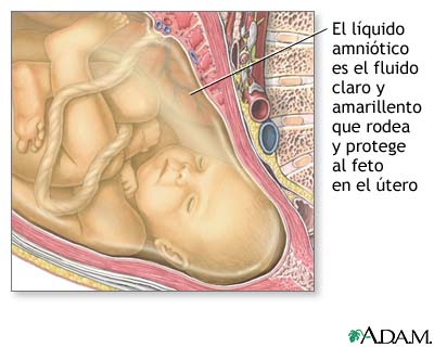 L&iacute;quido amni&oacute;tico