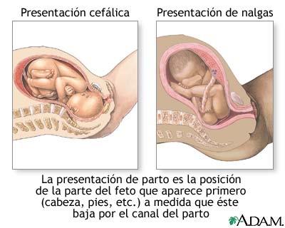 Presentaciones de parto