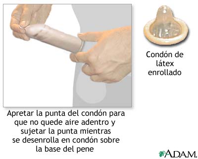 El cond&oacute;n masculino