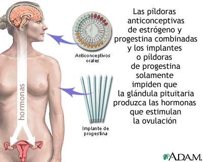 Anticonceptivos a base de hormonas