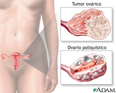 Sobreproducci&oacute;n ov&aacute;rica