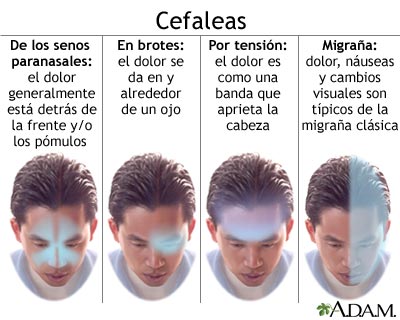 Dolor de cabeza