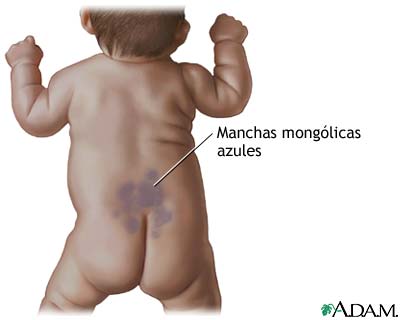 Manchas mong&oacute;licas