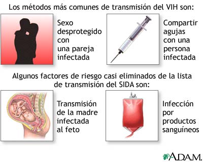 Infecci&oacute;n primaria por VIH