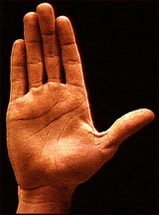 Anatom&iacute;a de la superficie de la palma de la mano normal