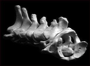 V&eacute;rtebra cervical del cuello