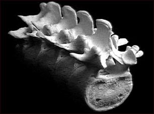 V&eacute;rtebras lumbares (parte baja de la espalda)