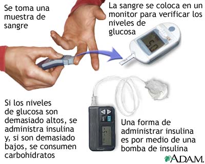 Examen de glucosa