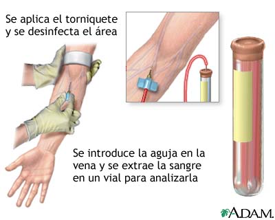 Examen de sangre PSA