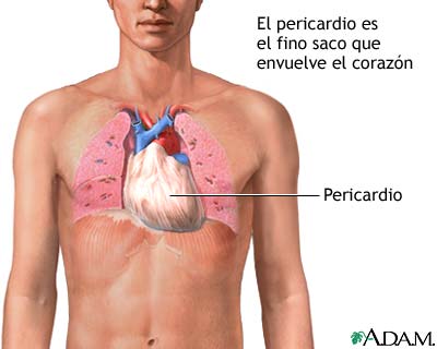 Pericardio