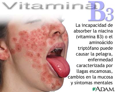 D&eacute;ficit de vitamina B3