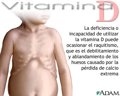 D&eacute;ficit de vitamina D