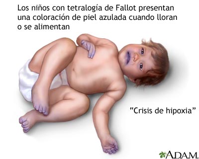 Episodios cian&oacute;ticos