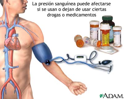 Hipertensi&oacute;n inducida por drogas