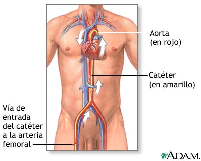 Procedimiento (primera parte)